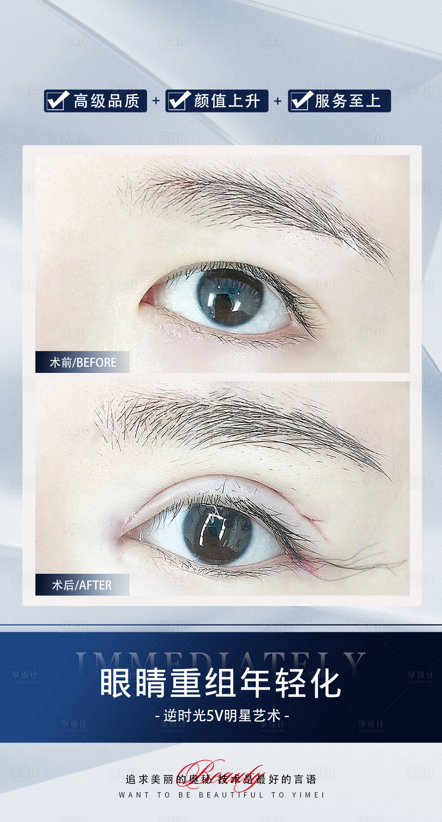 源文件下载【享设计】搜索编号：43240028043783243【双眼皮案例对比海报】