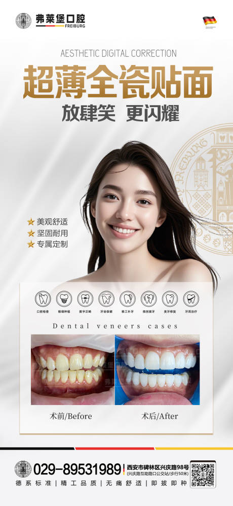 源文件下載【口腔貼面案例】編號：55110028429242086