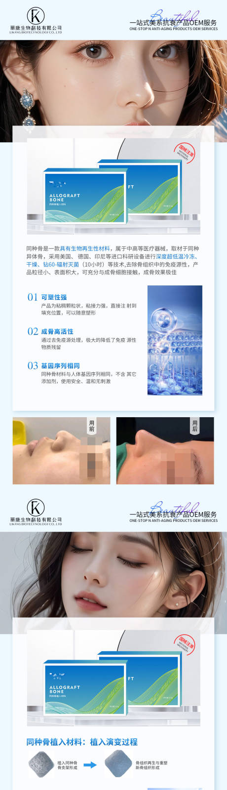 源文件下载【医美隆鼻海报】编号：87720028331232452