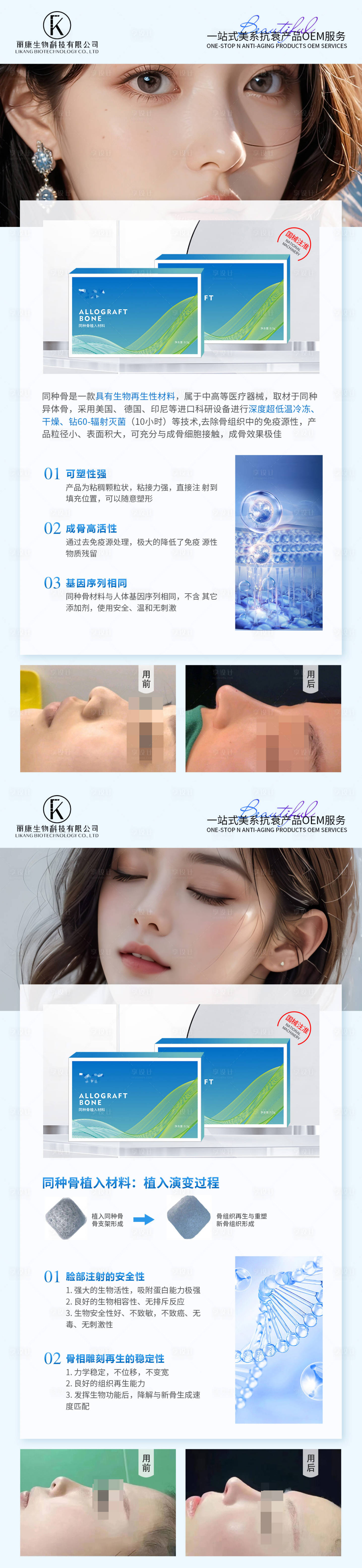 源文件下載【享設(shè)計】搜索編號：87720028331232452【醫(yī)美隆鼻海報】
