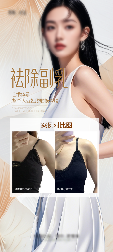 源文件下载【副乳吸脂案例海报】编号：92100028183435903