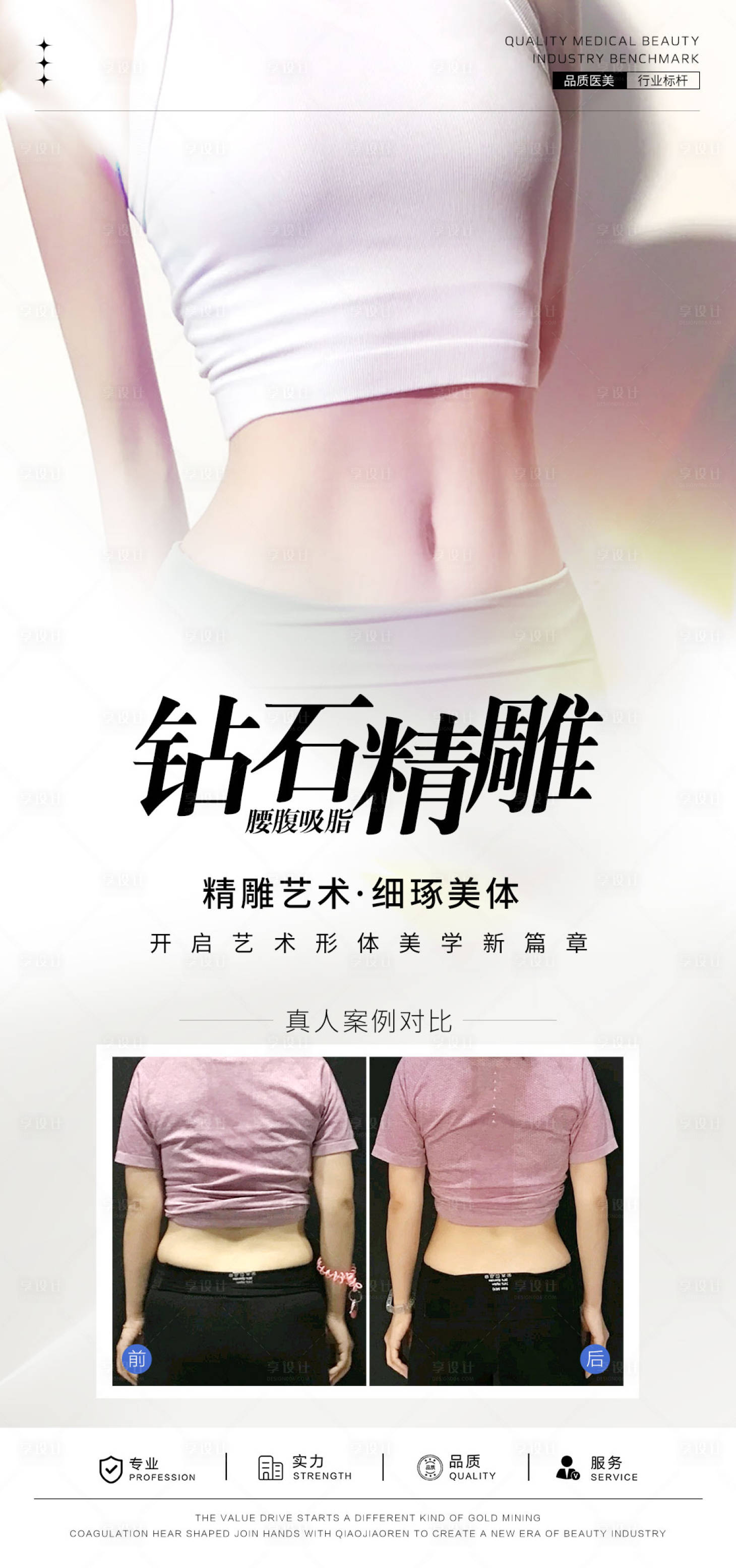 源文件下載【腰腹吸脂案例海報】編號：68930028197458202