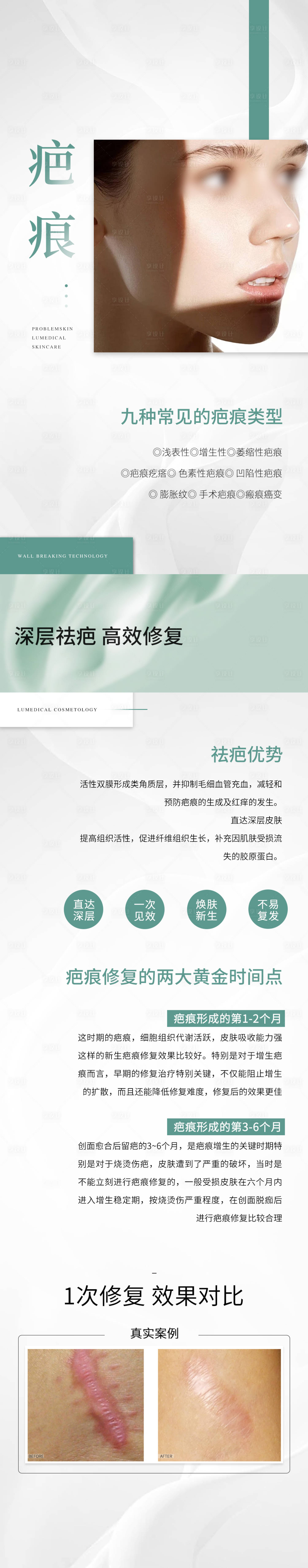 源文件下载【享设计】搜索编号：29260028560882391【疤痕问题肌】