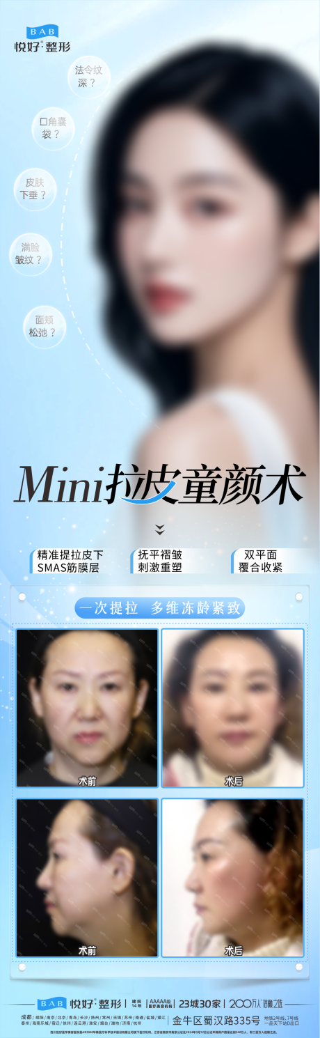 源文件下載【拉皮童顏術】編號：61810028213226107