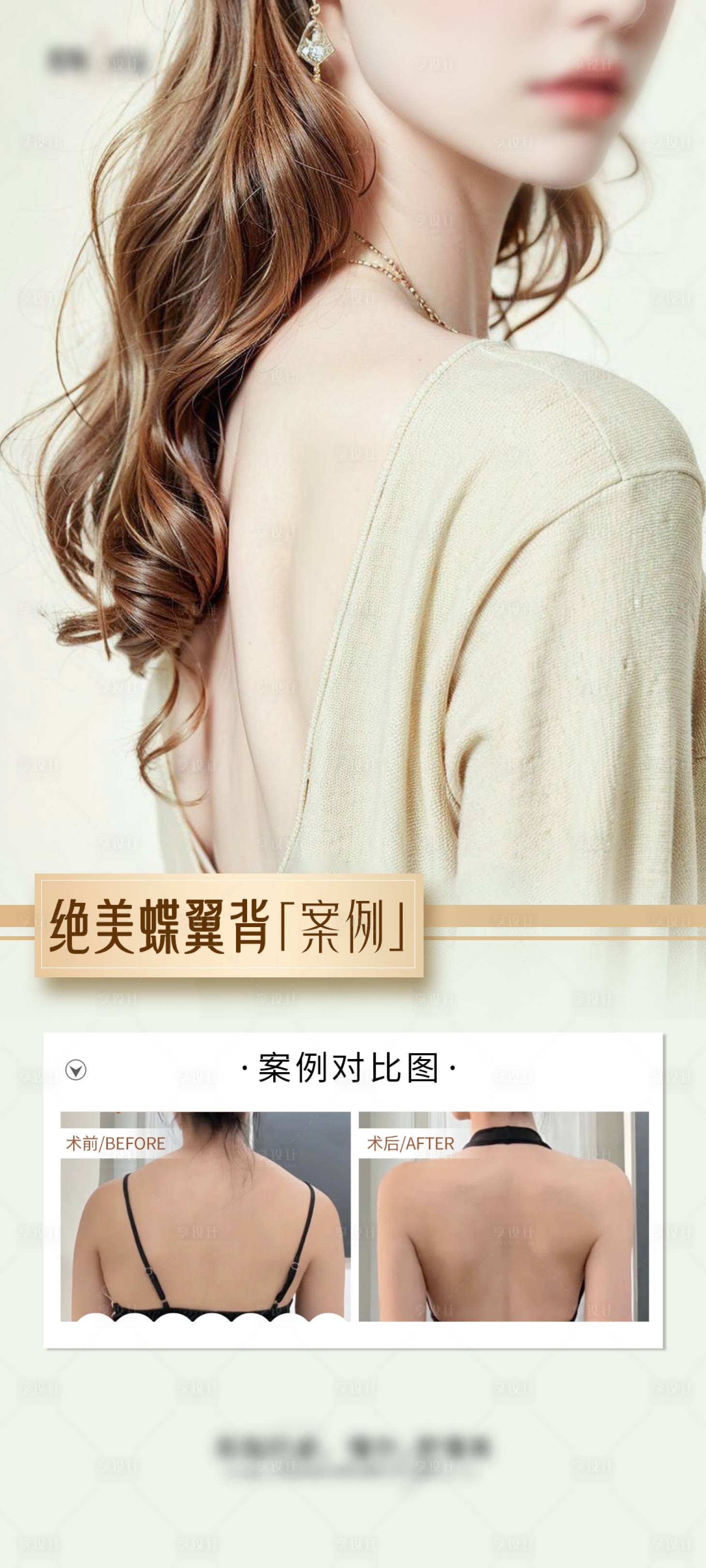 源文件下载【医美少女背海报】编号：45980028233791880