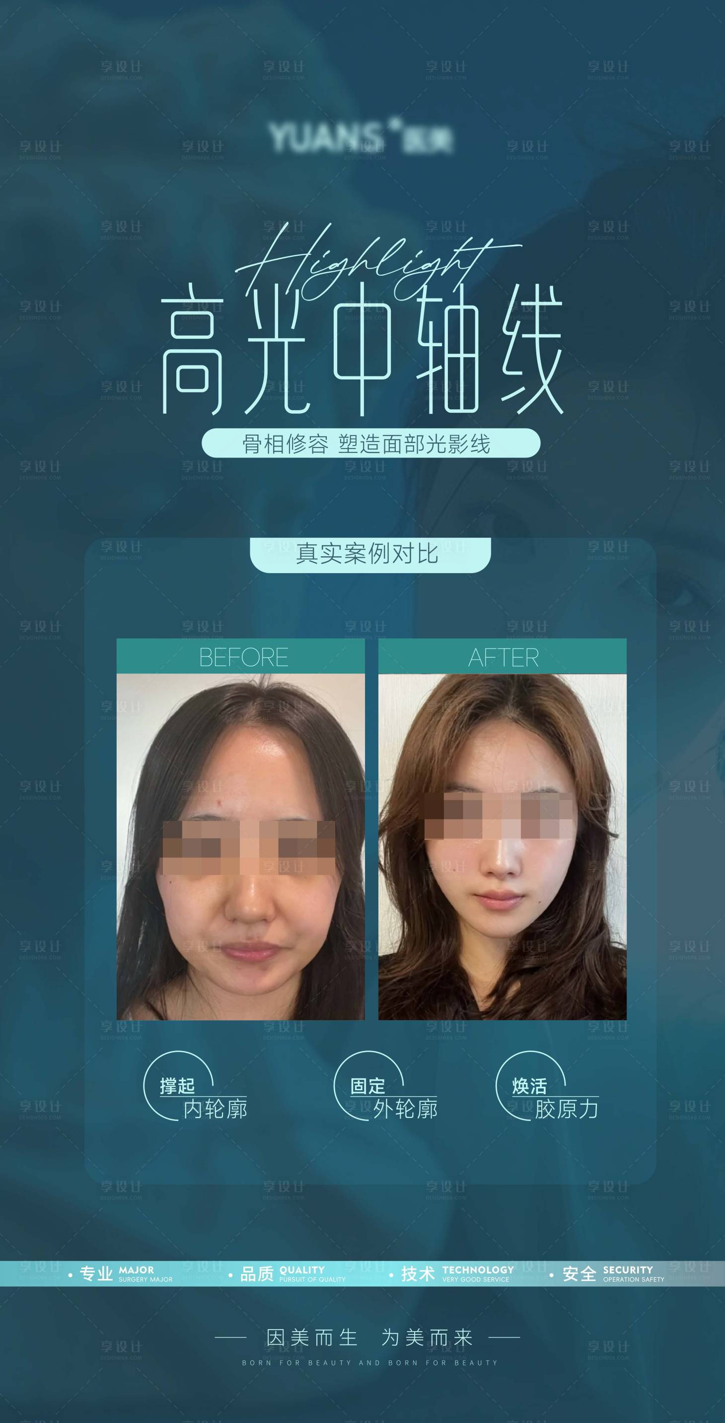 源文件下载【享设计】搜索编号：81870028287191077【医美轮廓案例对比】