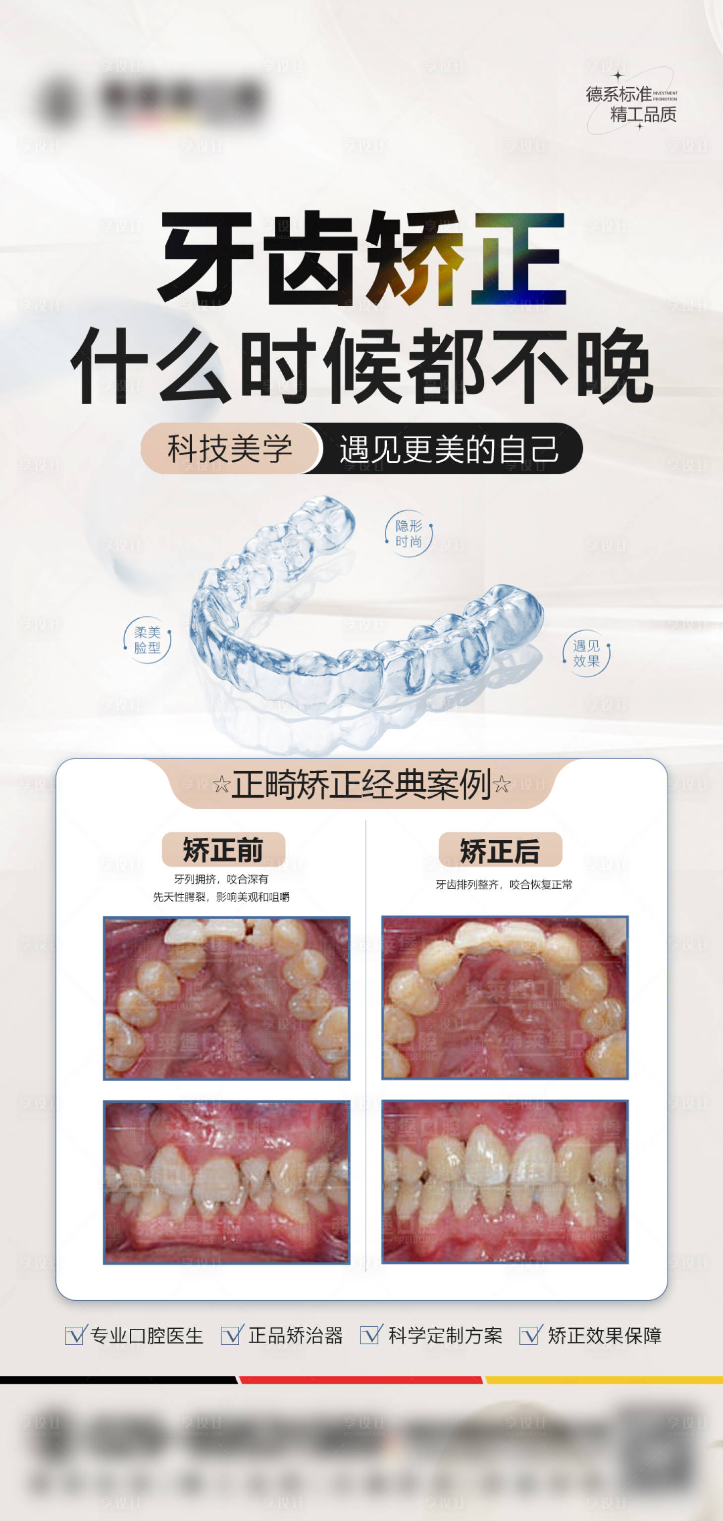 源文件下載【享設計】搜索編號：83200028471531421【正畸矯正案例】