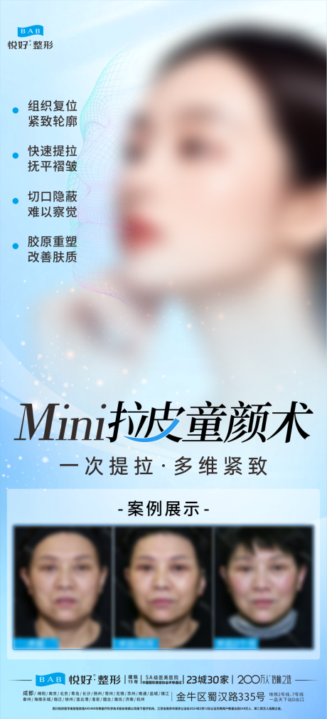 MINI拉皮童颜术
