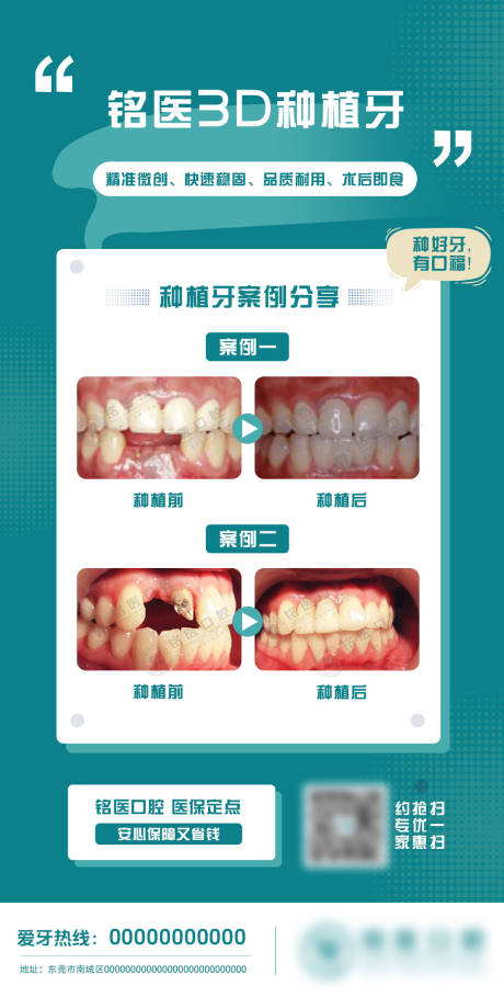 源文件下载【种植牙案例分享海报】编号：51610028381883768