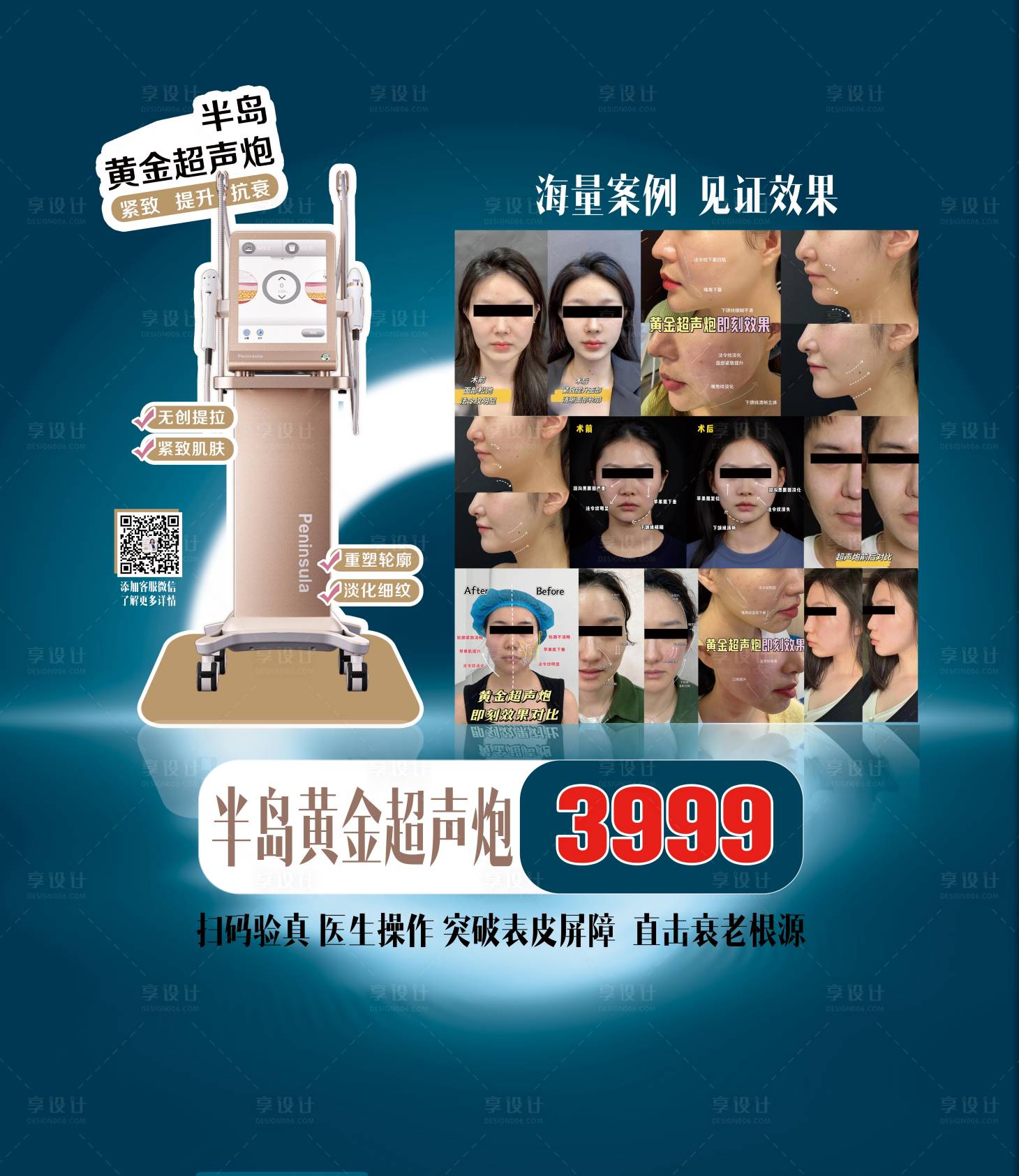 源文件下载【享设计】搜索编号：76430028331565700【黄金超声炮 】