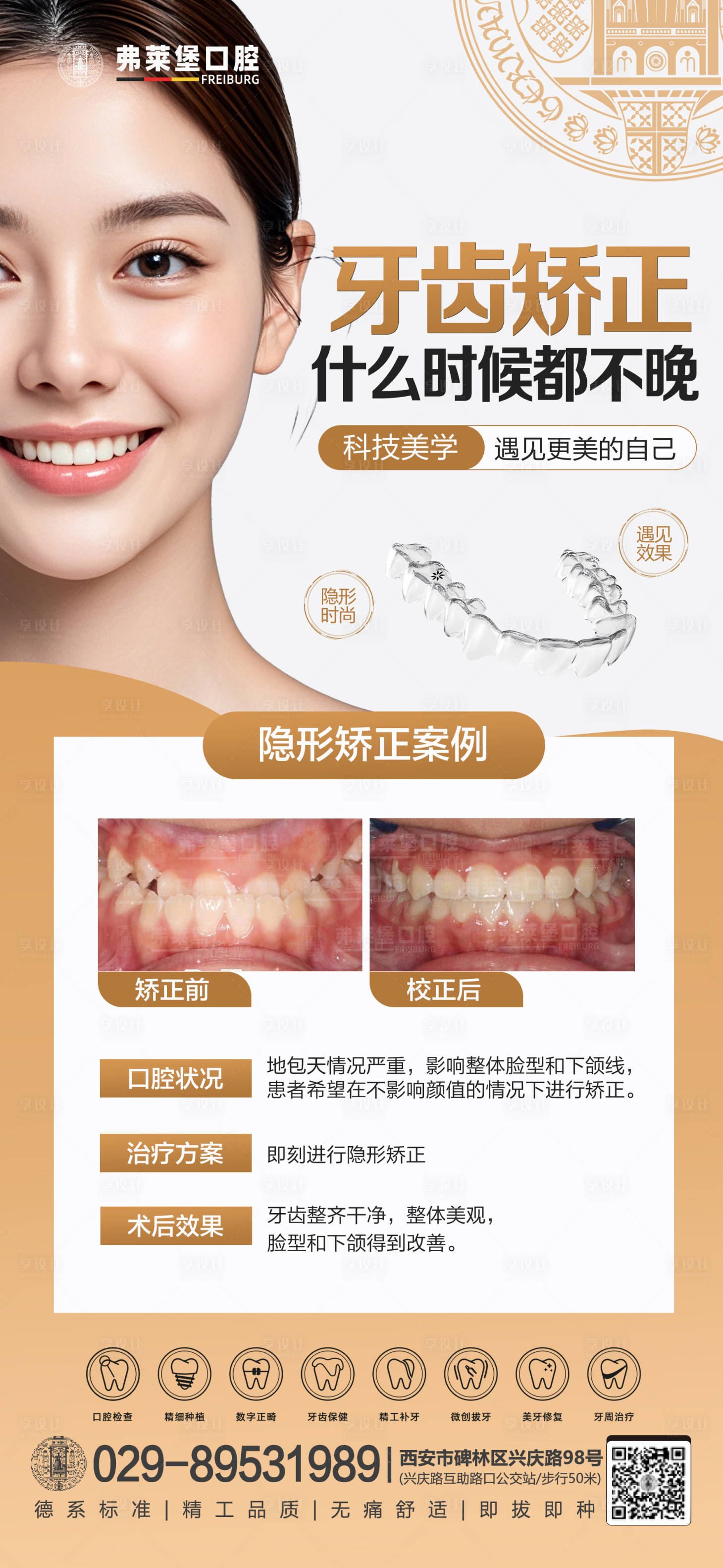 源文件下載【享設(shè)計(jì)】搜索編號(hào)：57260028429348837【牙齒矯正】