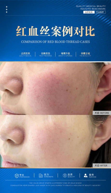 源文件下載【紅血絲案例對比】編號：91710028197259961