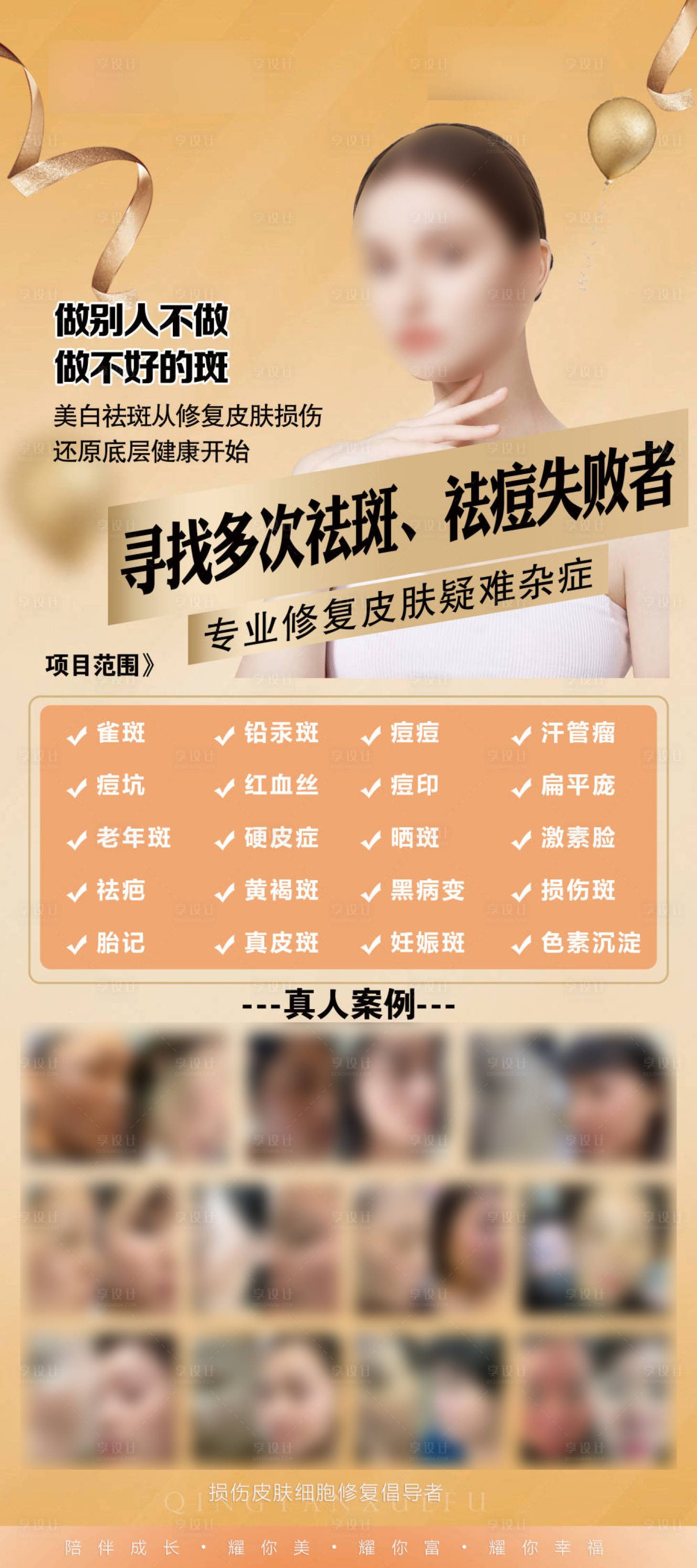 源文件下載【享設(shè)計(jì)】搜索編號(hào)：19130028398574240【祛斑祛痘案例海報(bào)】