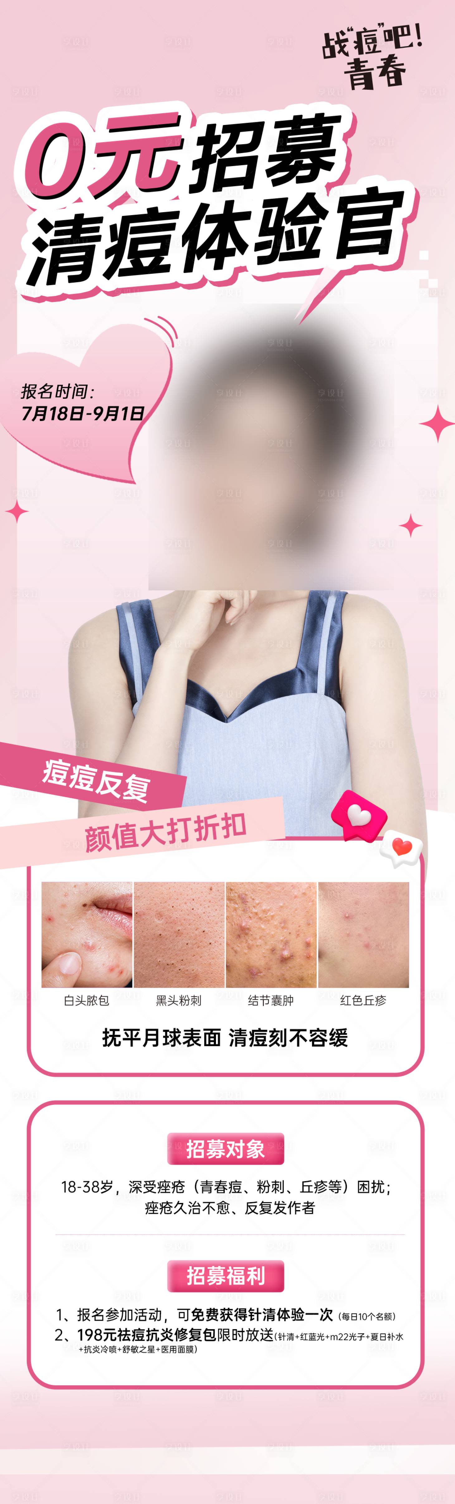 源文件下载【享设计】搜索编号：93530028430752518【医美祛痘海报 】
