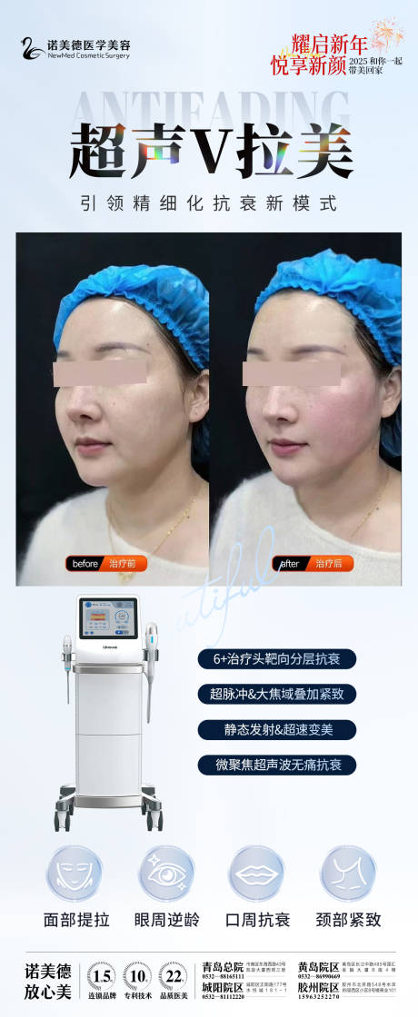 医美抗衰超声V拉美仪器
