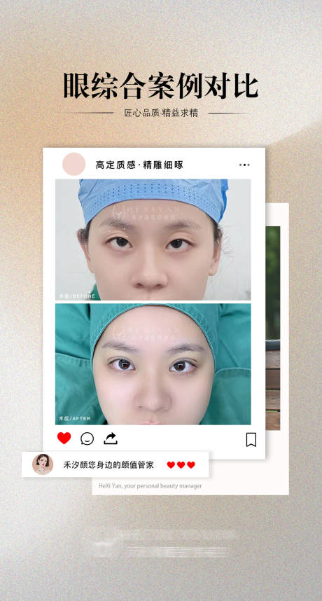 源文件下载【享设计】搜索编号：21150028496156551【医美眼综合案例海报】