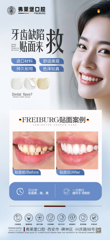 牙齿贴面案例海报