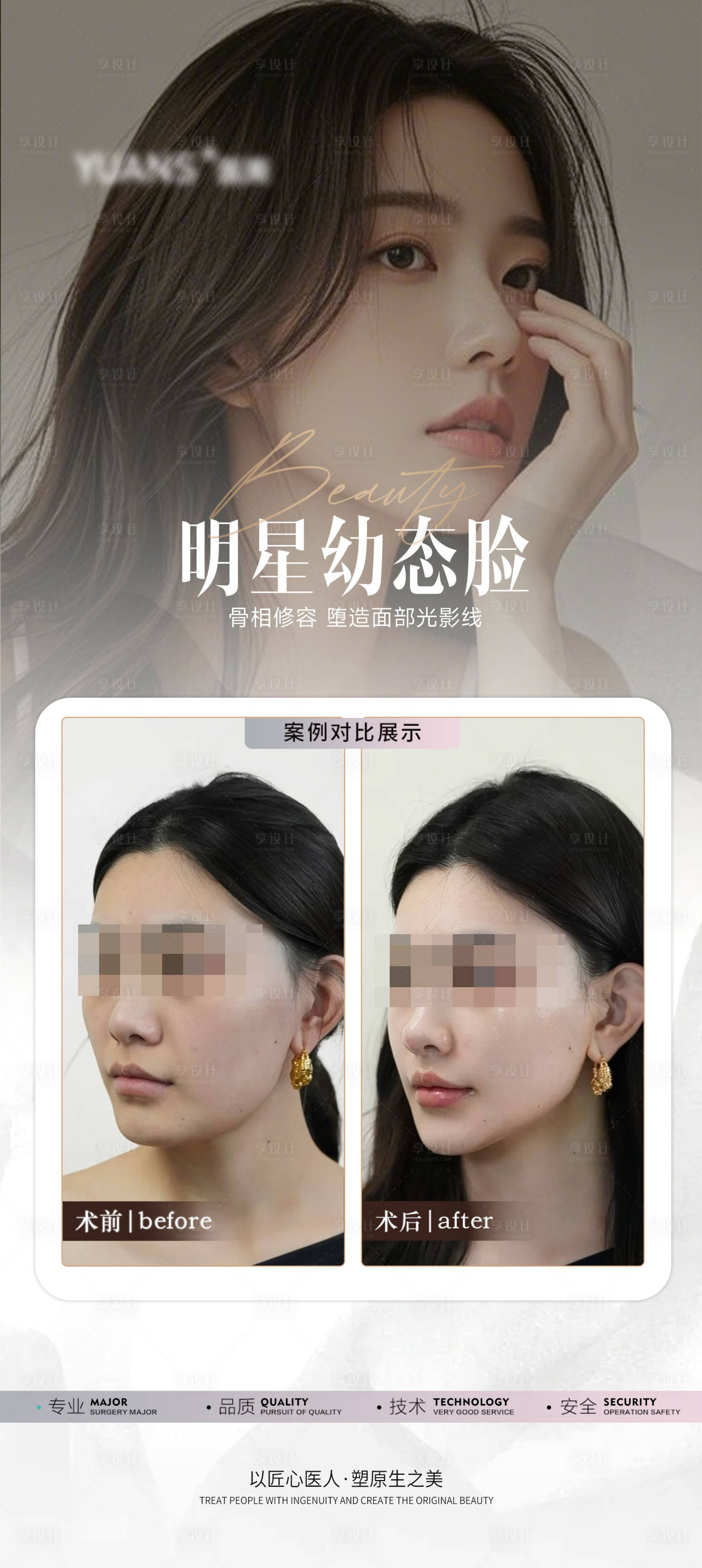 源文件下載【享設計】搜索編號：26050028413014216【醫美輪廓案例對比】