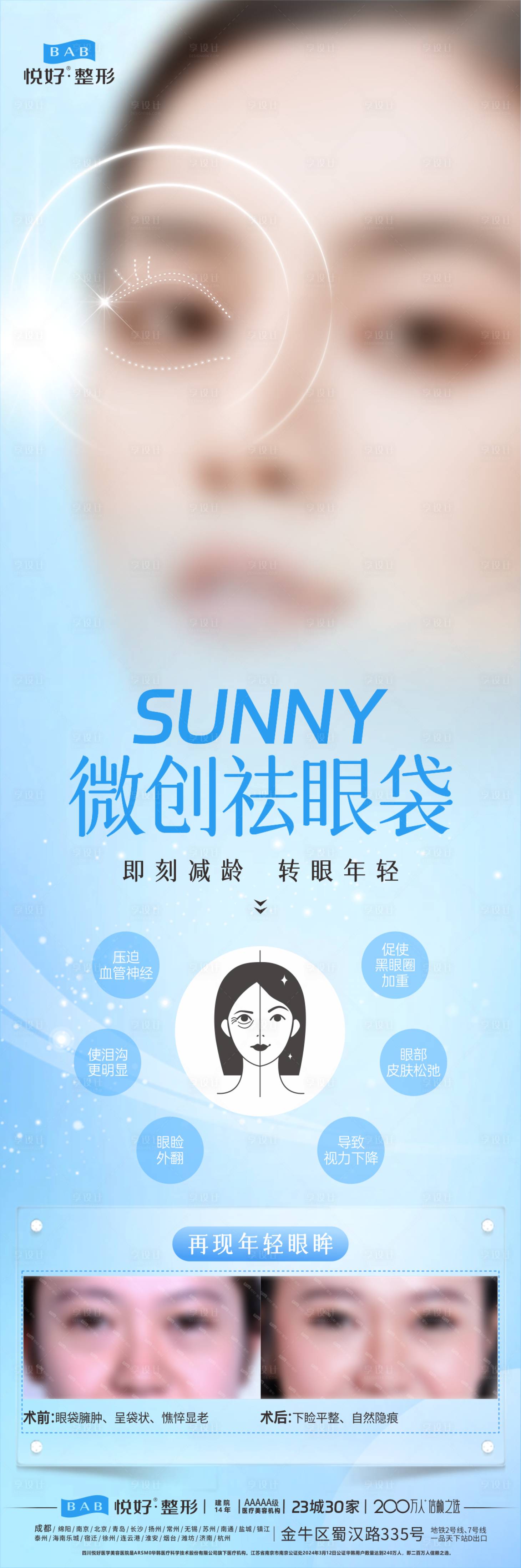 源文件下載【享設(shè)計(jì)】搜索編號(hào)：73460028213282472【微創(chuàng)祛眼袋海報(bào)長(zhǎng)圖】