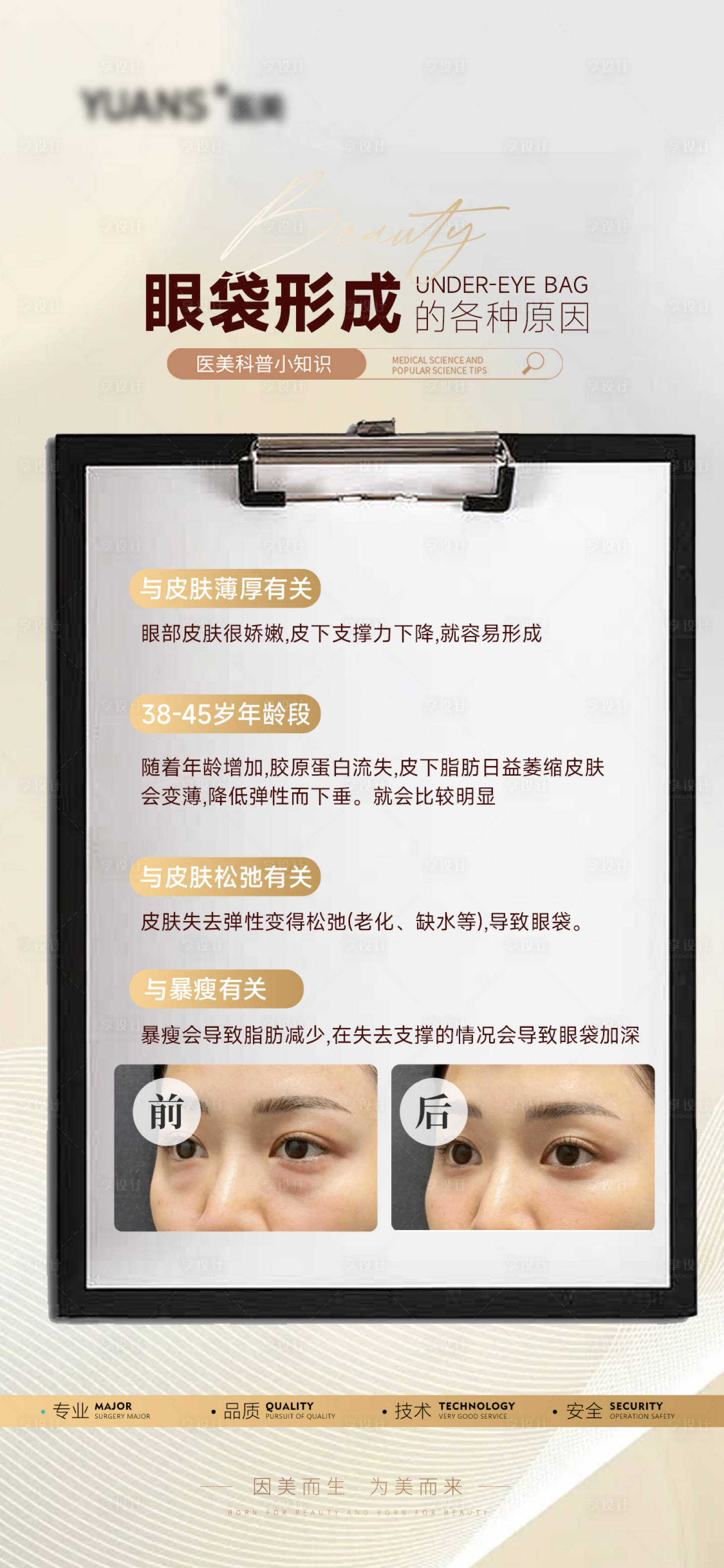 源文件下载【享设计】搜索编号：39320028339514838【医美眼袋案例科普海报】