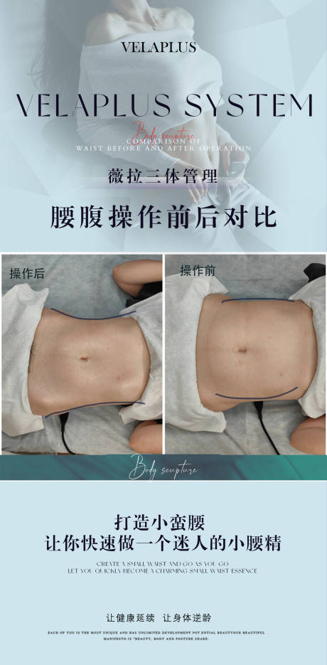 腰腹前后对比海报