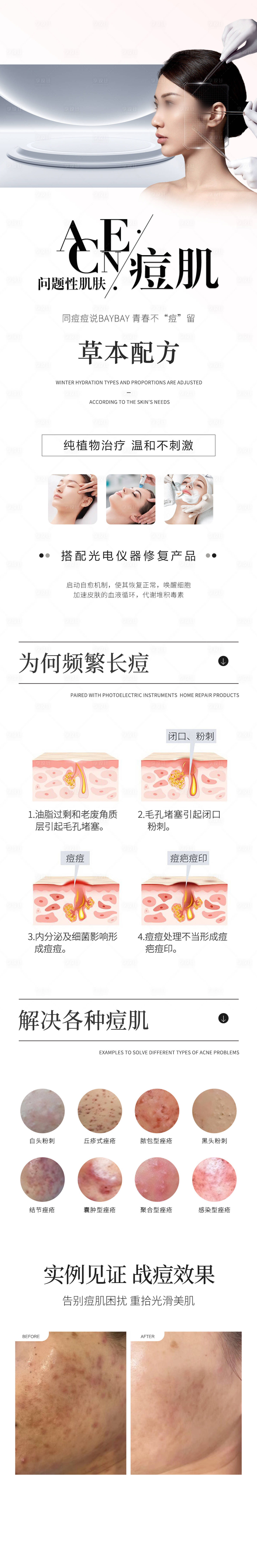 源文件下载【问题性肌肤痘痘】编号：48010028561353235