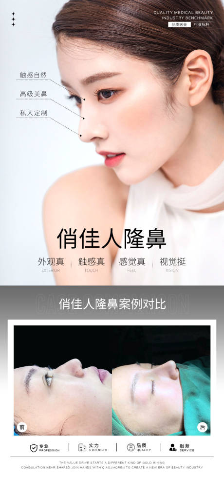 源文件下载【隆鼻案例海报】编号：12410028197345915