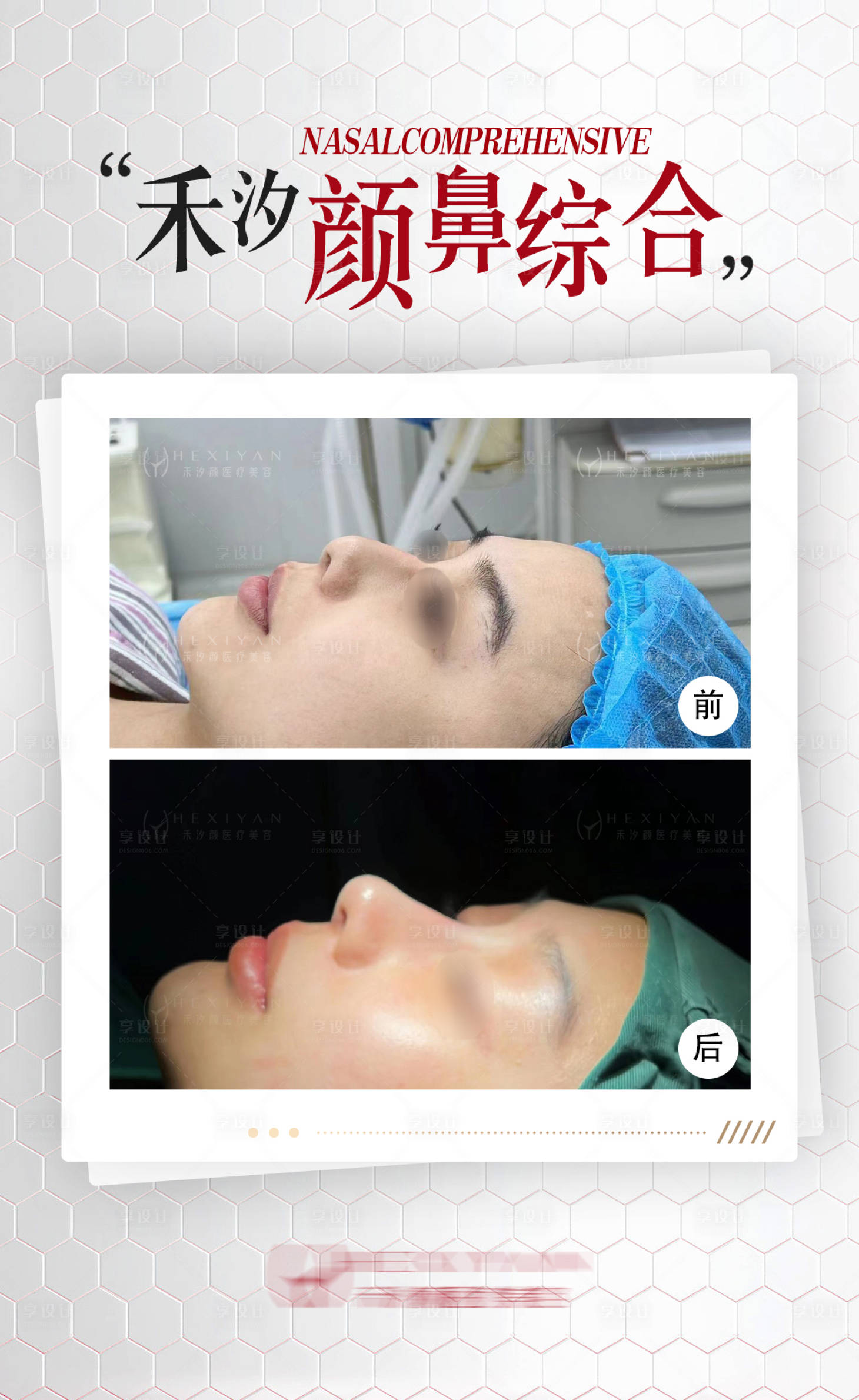源文件下載【享設計】搜索編號：64770028496007116【醫美案例海報】