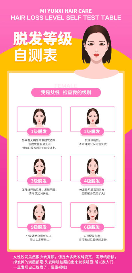 女性脱发等级