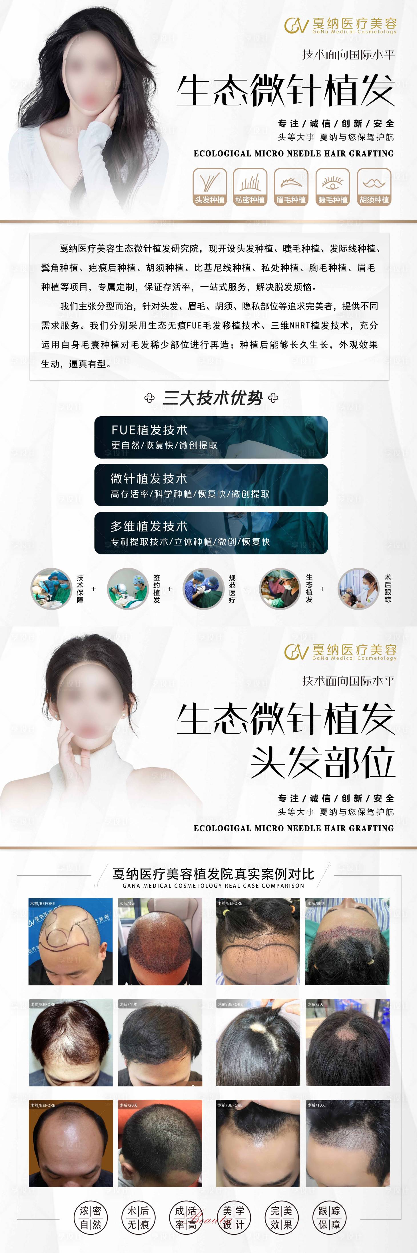 源文件下載【享設計】搜索編號：80350028802589411【生態微針植發KT版海報】