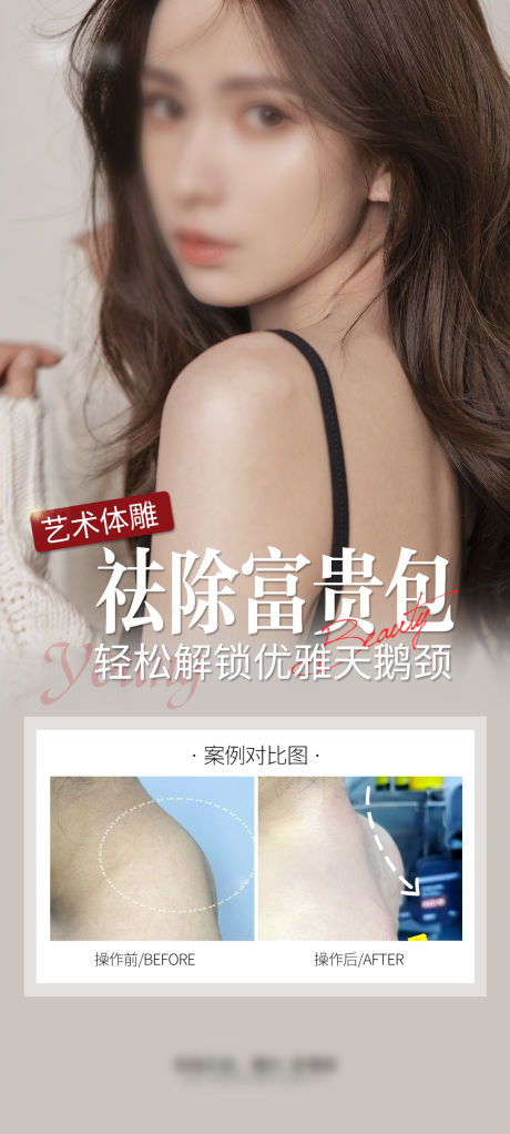 源文件下载【享设计】搜索编号：35130028971452215【祛除富贵包案例海报】