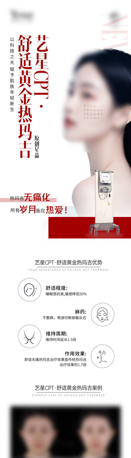 源文件下载【医美仪器案例对比热玛吉长图】编号：60810029004761297