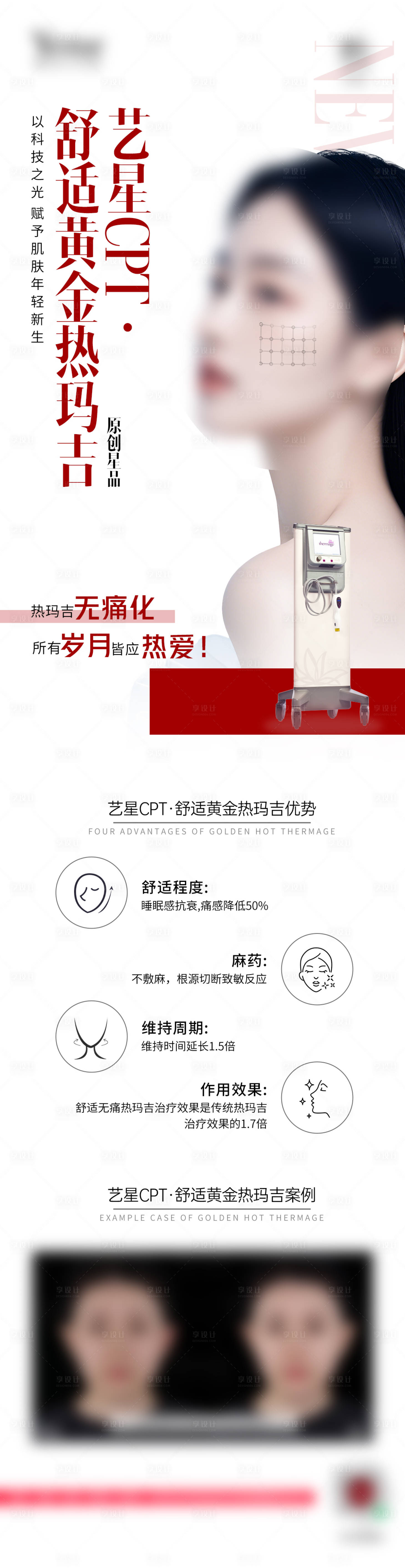 源文件下載【享設(shè)計】搜索編號：60810029004761297【醫(yī)美儀器案例對比熱瑪吉長圖】