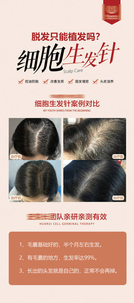 源文件下载【医美植发展架海报】编号：71990028879007069