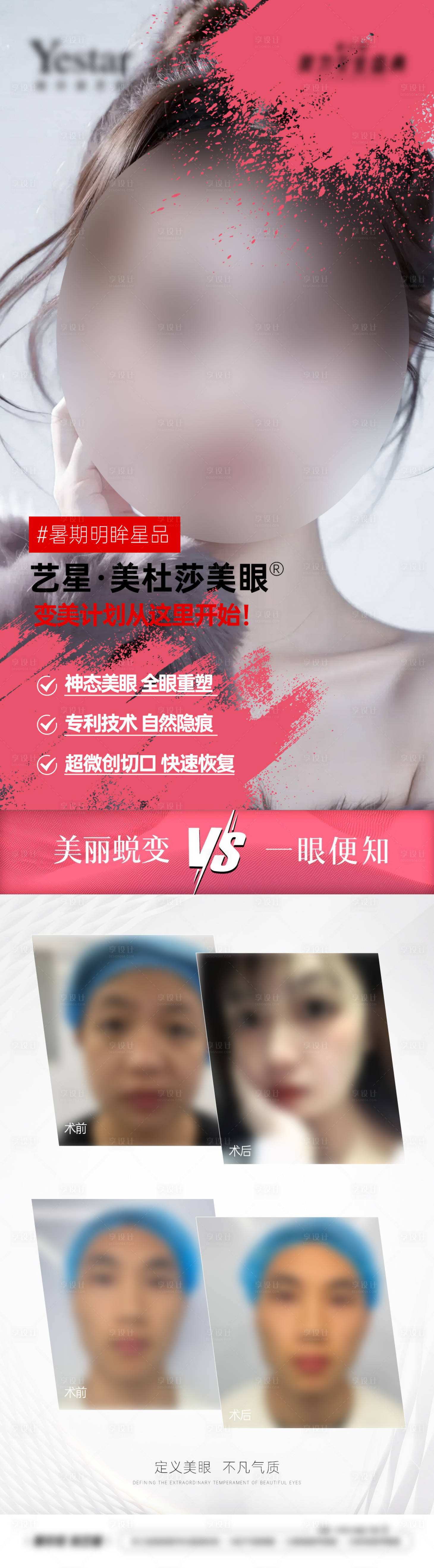源文件下载【医美双眼皮整外美眼项目案例对比】编号：12090028956505343