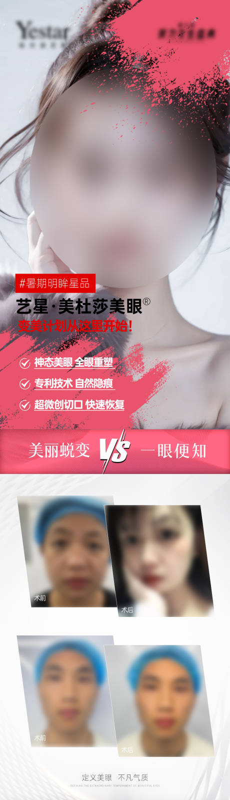 医美双眼皮整外美眼项目案例对比