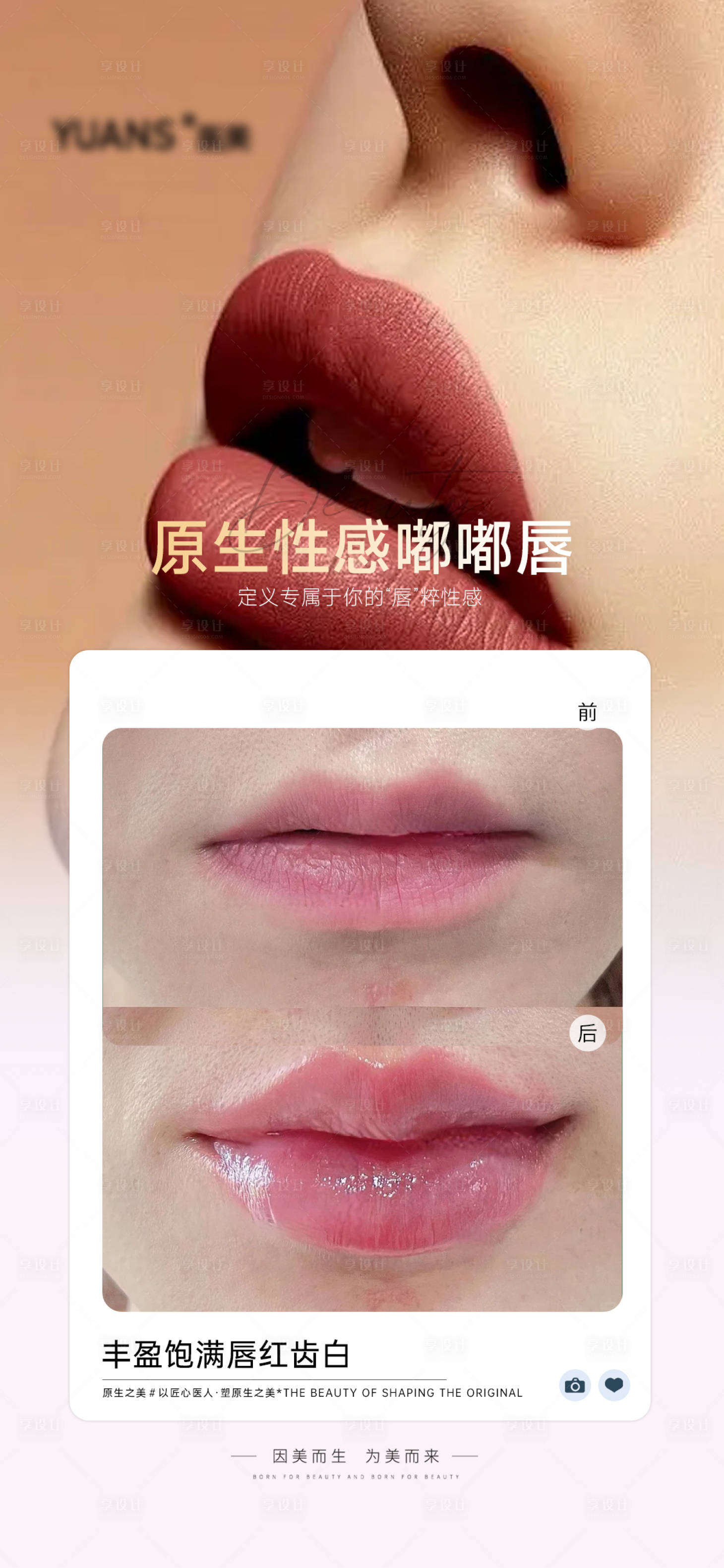 源文件下載【享設計】搜索編號：84370028971261040【醫美嘟嘟唇案例對比】