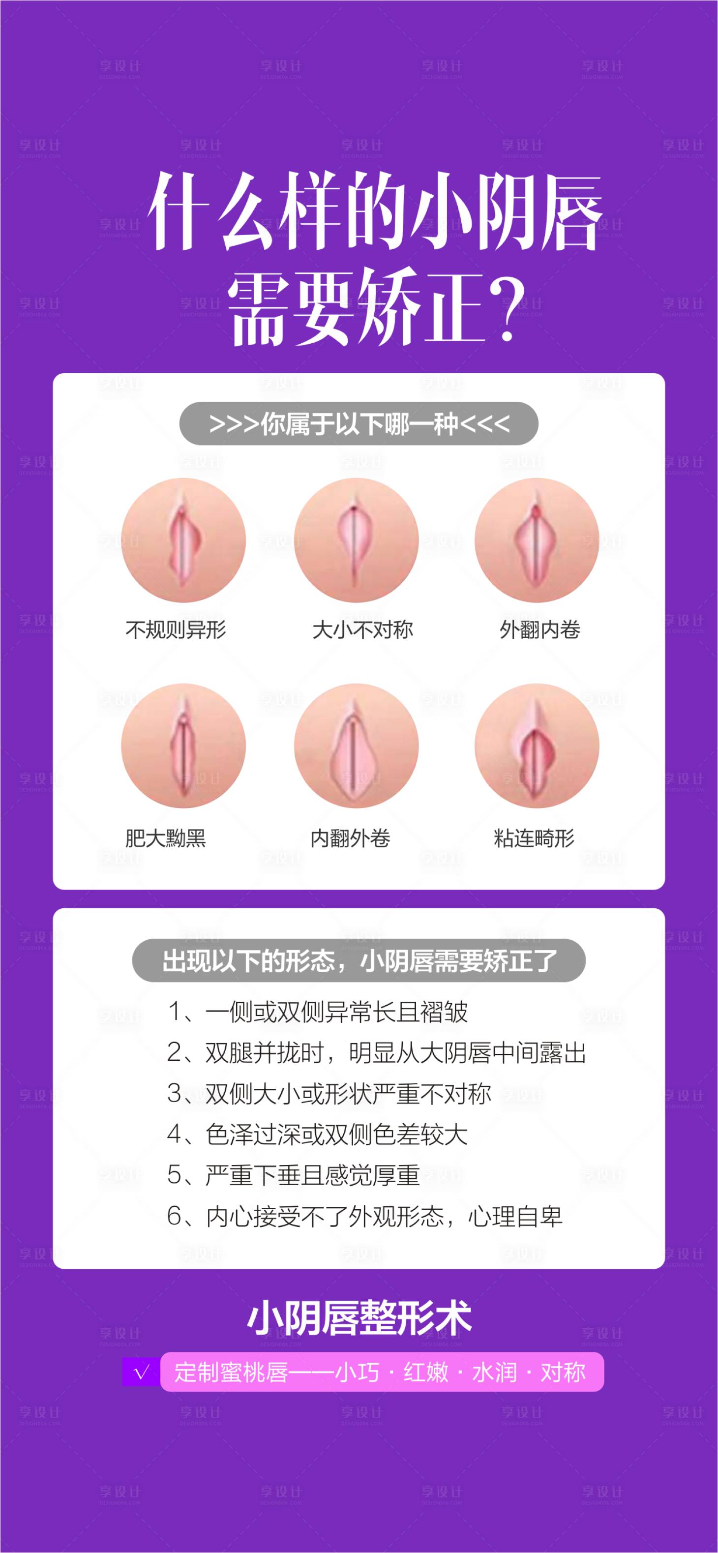 源文件下載【享設(shè)計(jì)】搜索編號(hào)：97000028935918713【私密整形  】