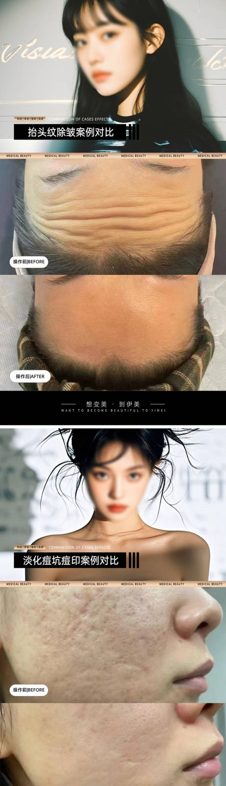 源文件下载【医美案例对比模板海报】编号：56360028939266441