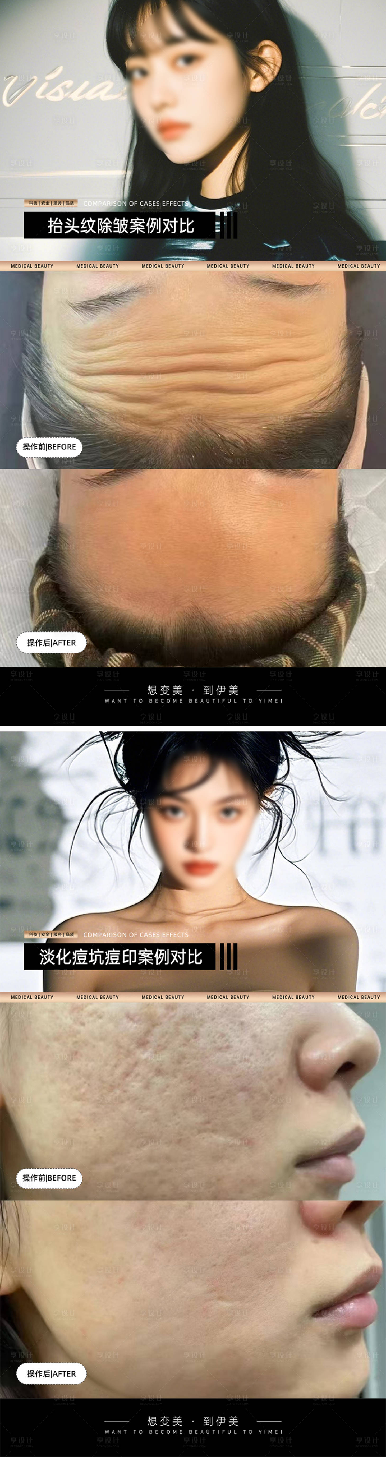 源文件下载【享设计】搜索编号：56360028939266441【医美案例对比模板海报】