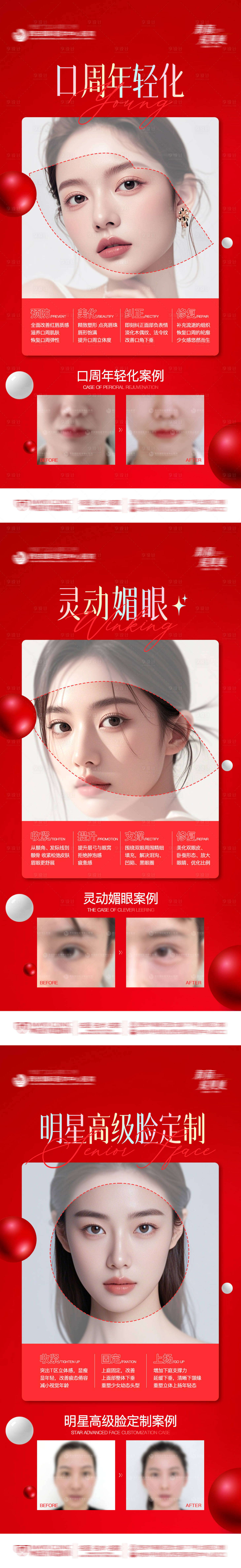 源文件下載【醫美整形口周年輕化靈動媚眼術明星高級】編號：53010028620306253