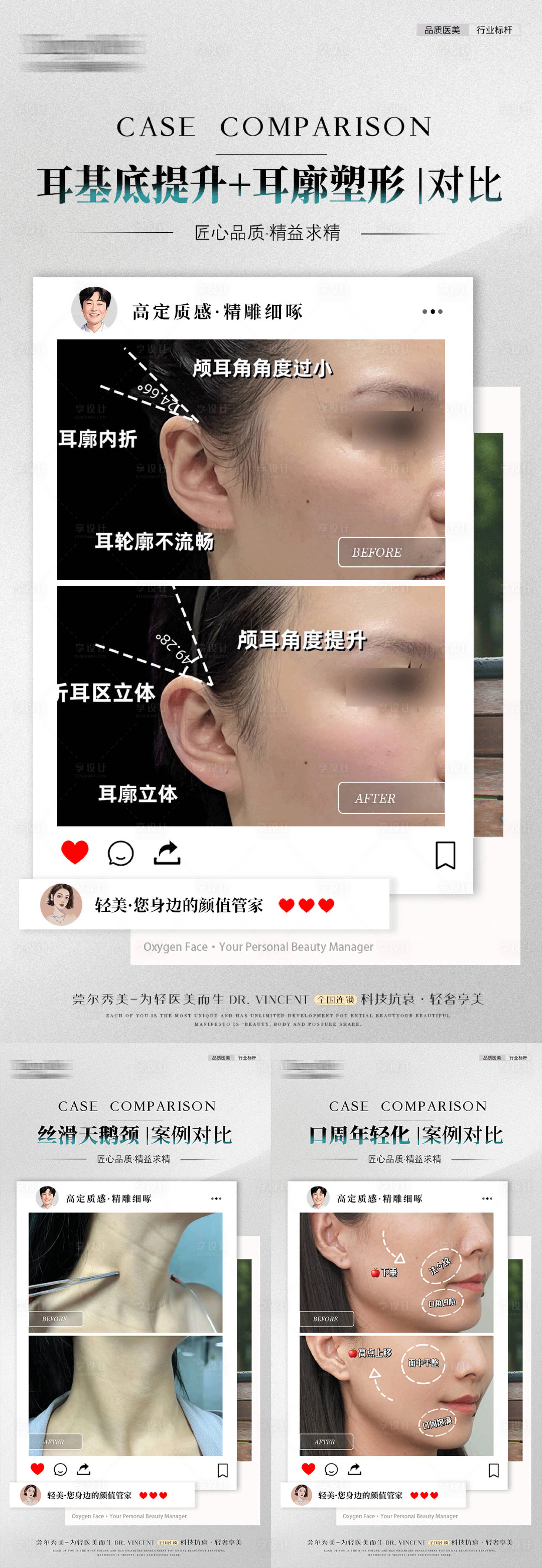 源文件下載【美業案例對比海報】編號：58710029032896082