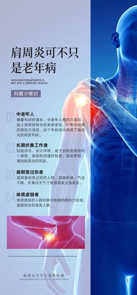 肩周炎常识知识小百科