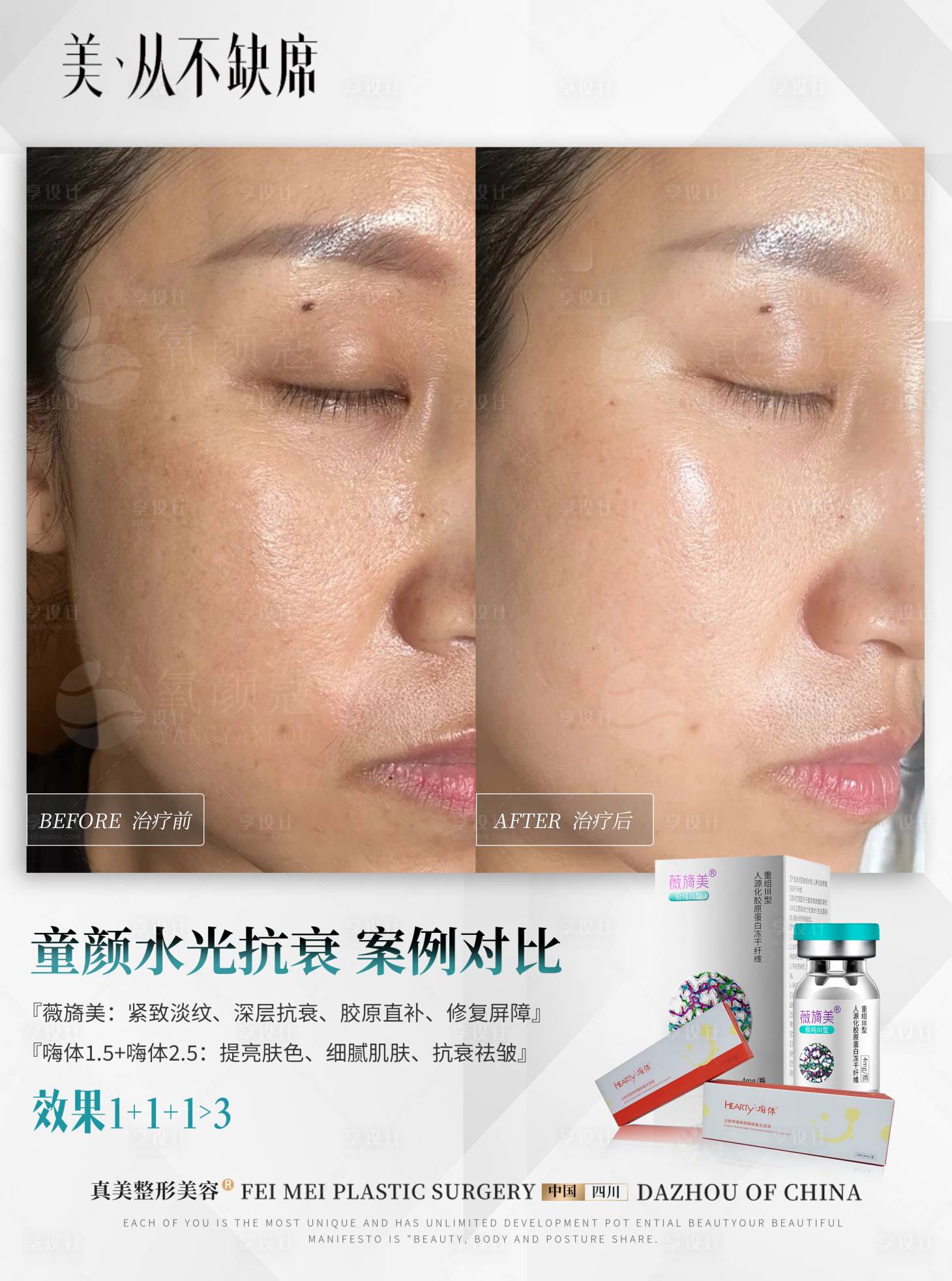 源文件下载【享设计】搜索编号：76150028871954730【童颜水光抗衰案例】