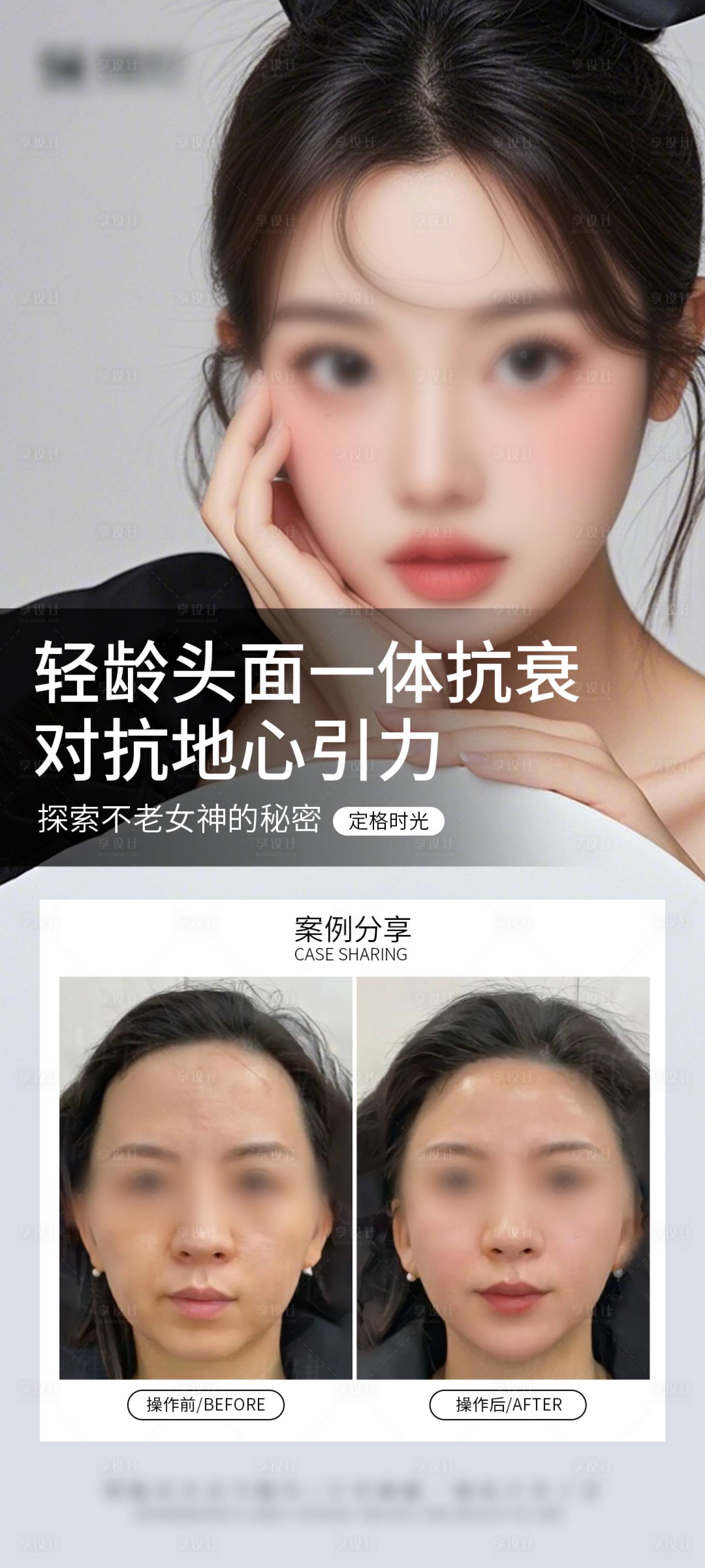 源文件下載【享設計】搜索編號：63820028977163980【抗衰案例海報】