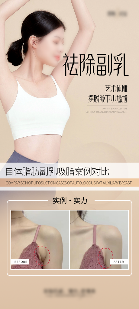 源文件下载【祛除副乳案例宣传海报】编号：42900028758888696