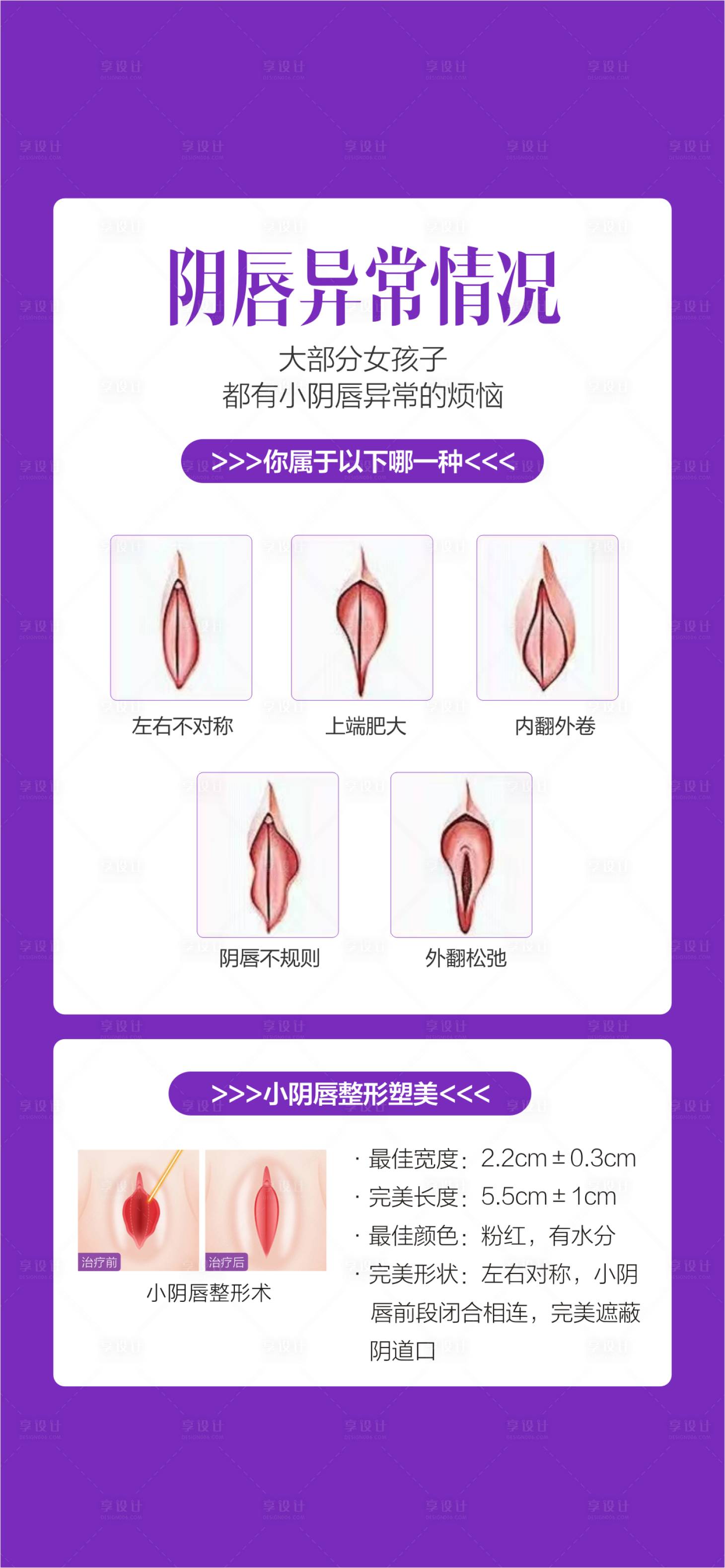 源文件下載【享設計】搜索編號：26460028935989457【私密整形 】