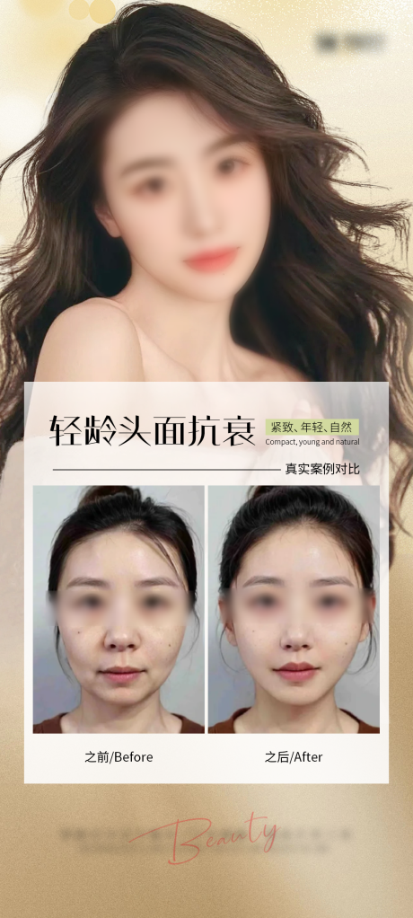 源文件下载【抗衰案例海报】编号：20500028971652285