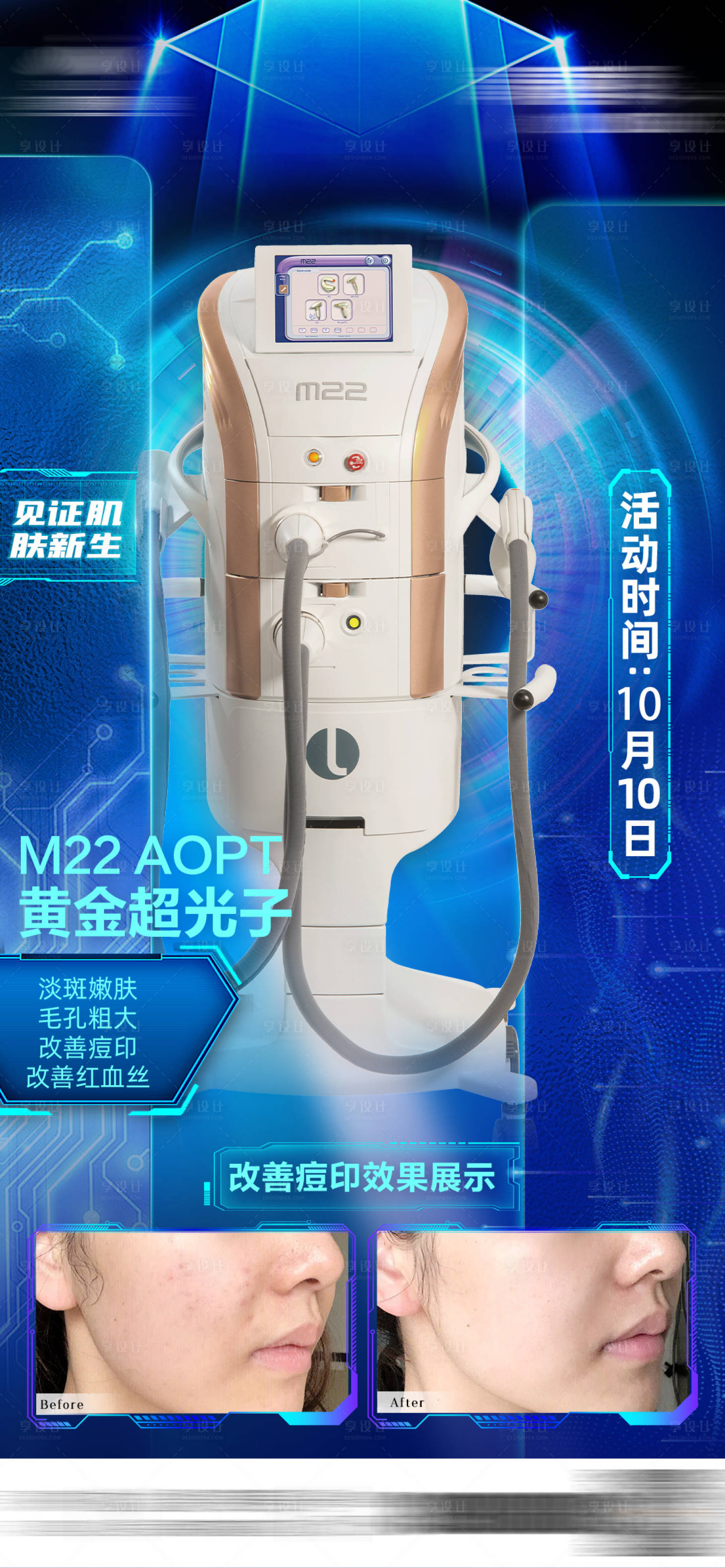 源文件下載【享設(shè)計(jì)】搜索編號：63540028899224446【M22科技抗衰海報(bào)】