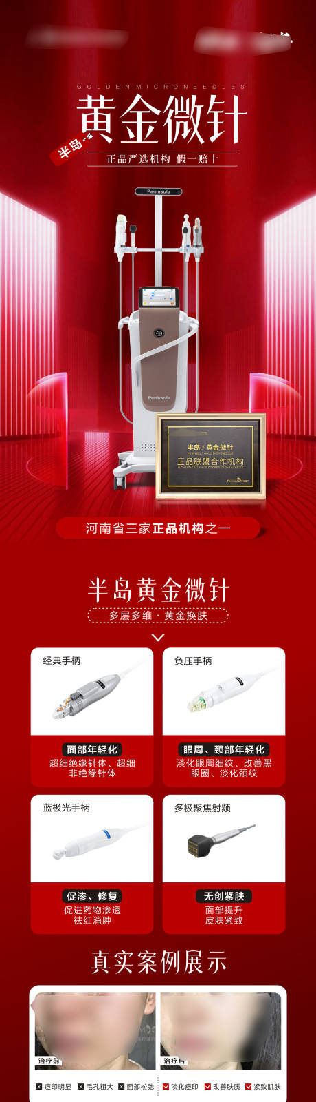 半岛黄金微针仪器案例宣传海报
